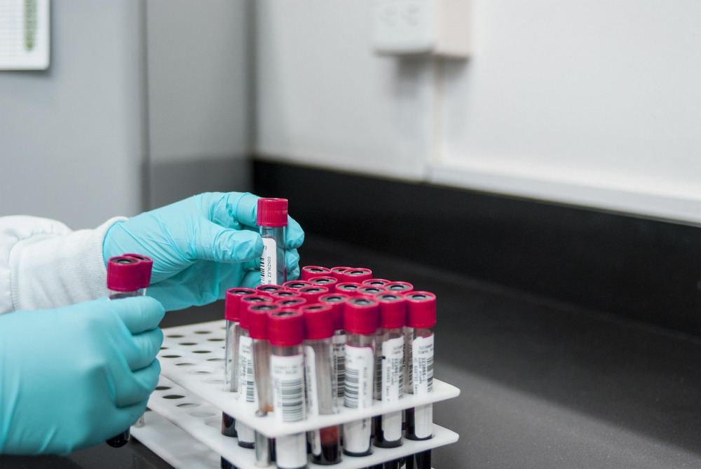 Laboratory testing and analysis